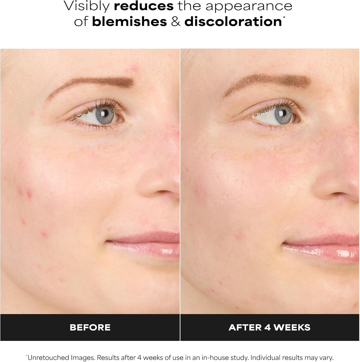 Paula's Choice BOOST 10% Azelaic Acid Booster Cream Gel Face Serum with Salicylic Acid, Minimizes Look of Redness & Fades Discoloration, Oil-Free Skin Brightening Serum for Face, Fragrance-Free - Image 3