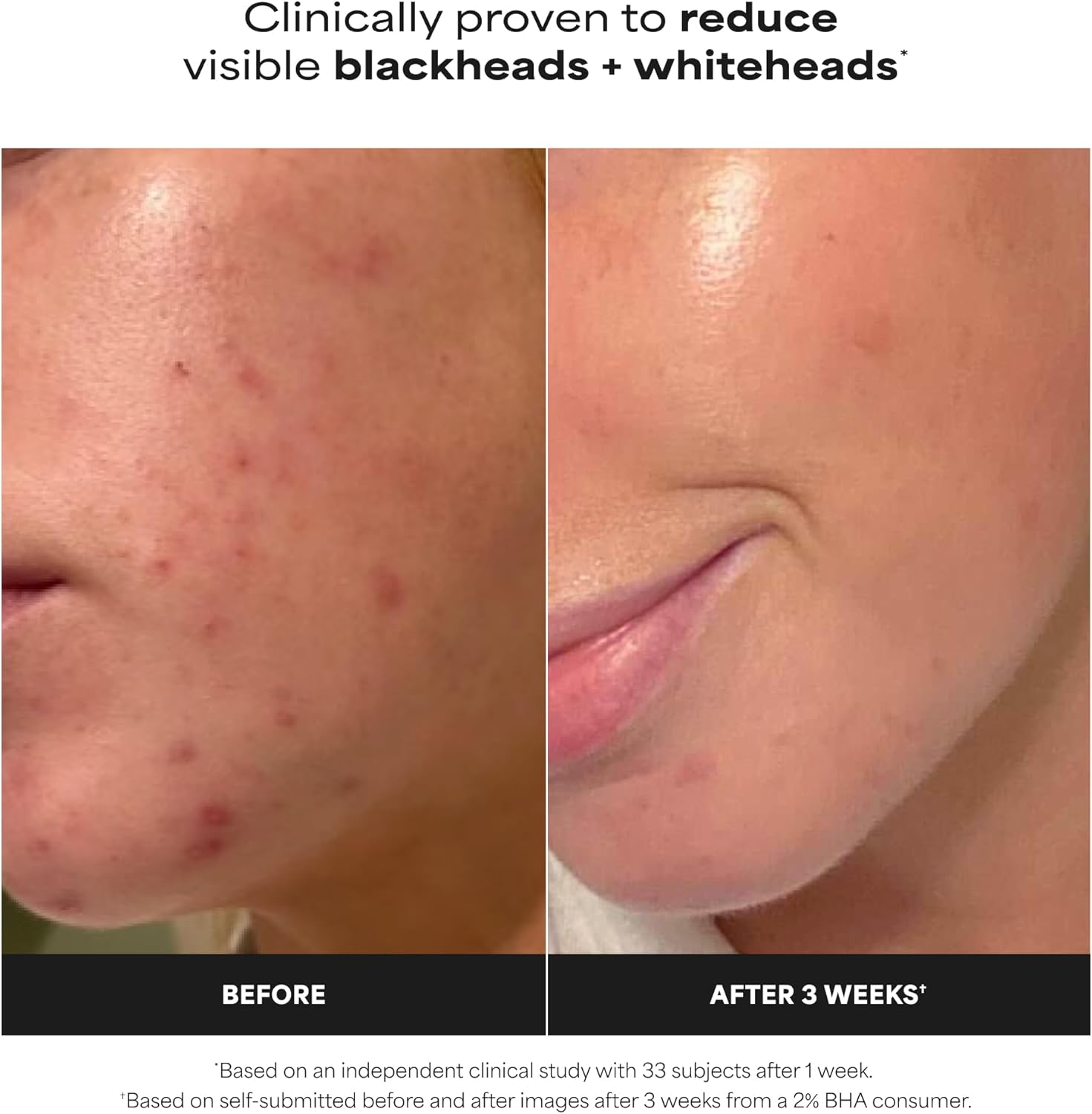 Paula's Choice SKIN PERFECTING 2% BHA Liquid Exfoliant with Salicylic Acid, Facial Polish for Pores, Wrinkles & Fine Lines, Suitable for Blackhead-Prone Skin, Fragrance-Free - Image 3