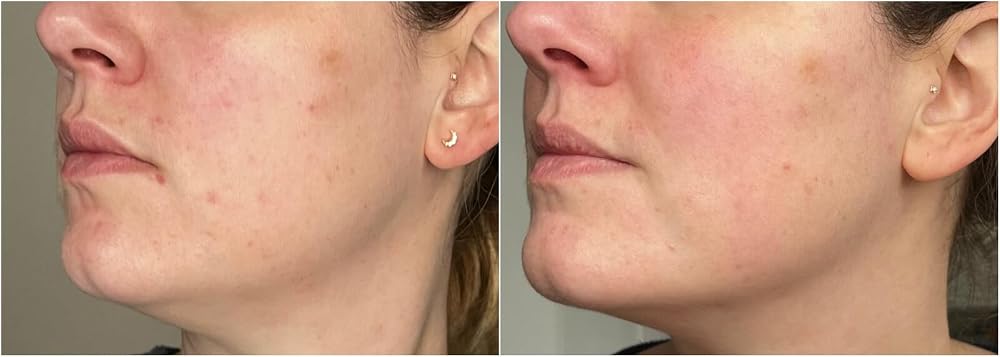 Erborian Yuza Cure, Gel Crème Anti-Taches, 25 ml | Cosmétique coréen, extrait de yuzu, atténue les marques pigmentaires, renforce la peau, teint homogène - Image 7