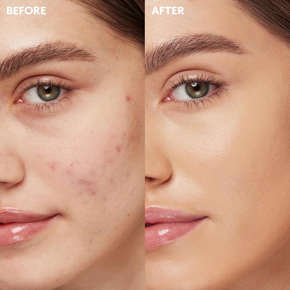 KIKO Milano Full Coverage 2-in-1 Foundation & Concealer 06 - WB 15, Fond De Teint/Correcteur 2 En 1 À Couvrance Élevée - Image 3