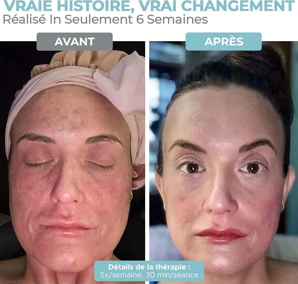 Nourished Bodynskin Masque LED 7 couleurs visage et cou avec infrarouge proche - Luminothérapie bleue, rouge pour le visage - 912 LED - Outil de soin pour l'anti-âge